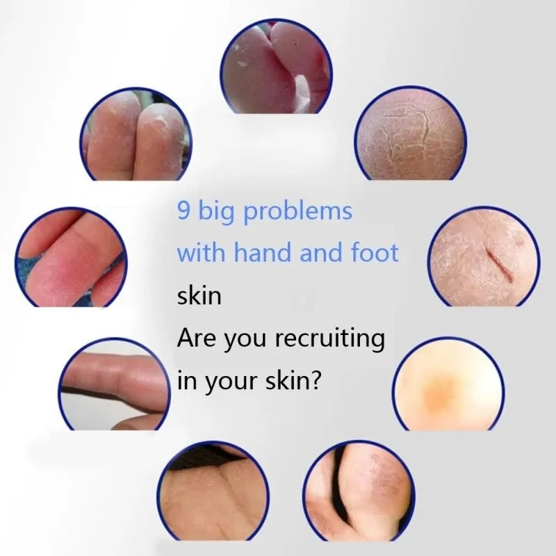 55G Anti Crack Foot Cream Oil Anti-Drying Crack Foot Mask Heel Cracked Repair Removal Dead Skin Chinese Herbal Hand Feet Care