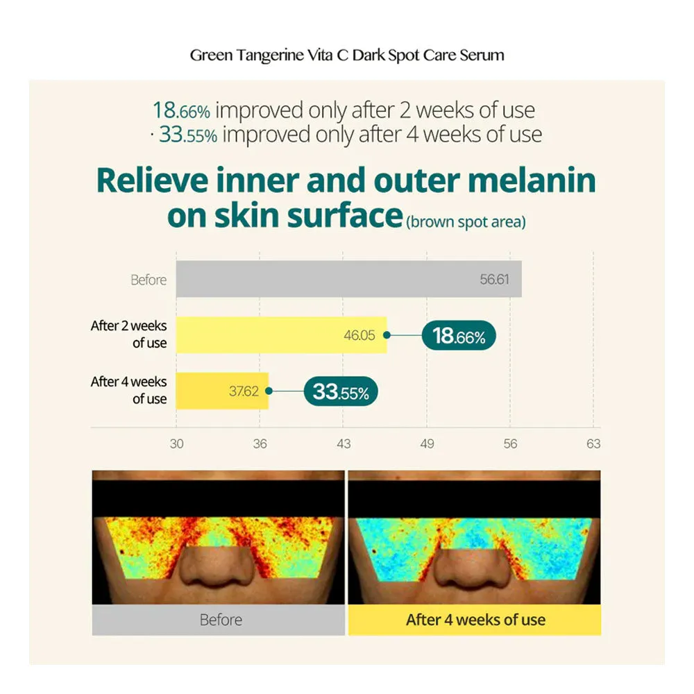 Green Tangerine Vita C Dark Spot Care Serum