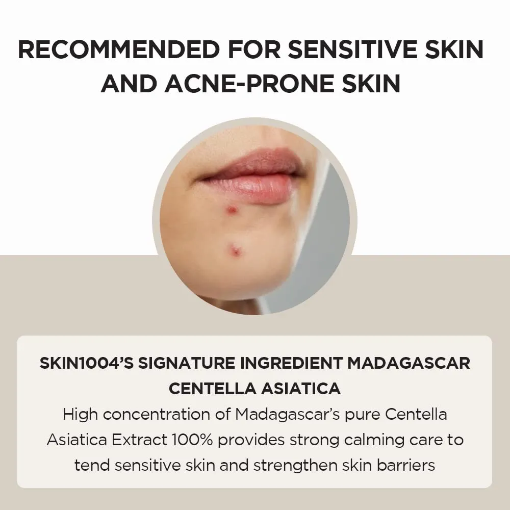 Madagascar Centella Asiatica Ampoule Facial Serum 1.85 fl.oz, 55ml, 100% Centella Asiatica Extract Soothes Acne Prone and Sensitive Skin