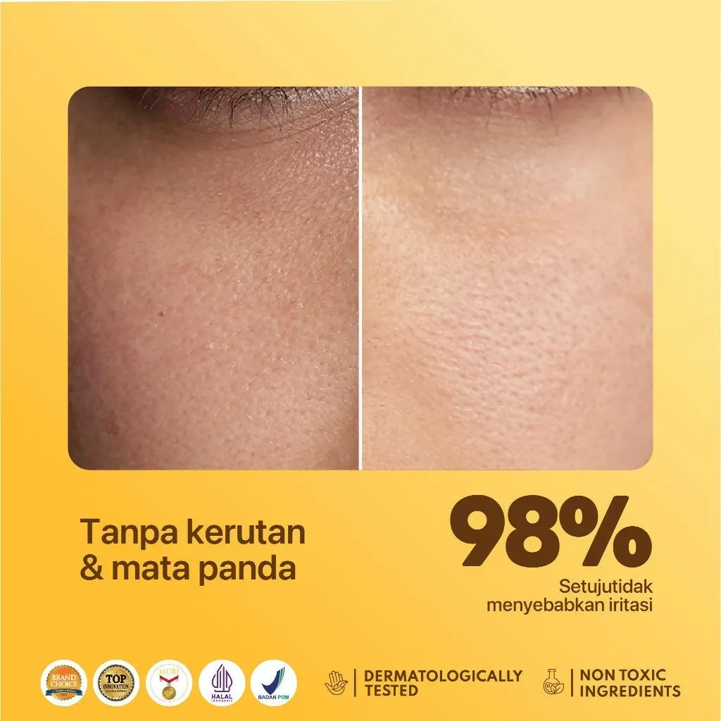 NPURE Eye Serum / Marigold / Eyemazing Power Serum Concentrate/ Krim Mata / Anti Mata Hitam Panda / Kantong Mata